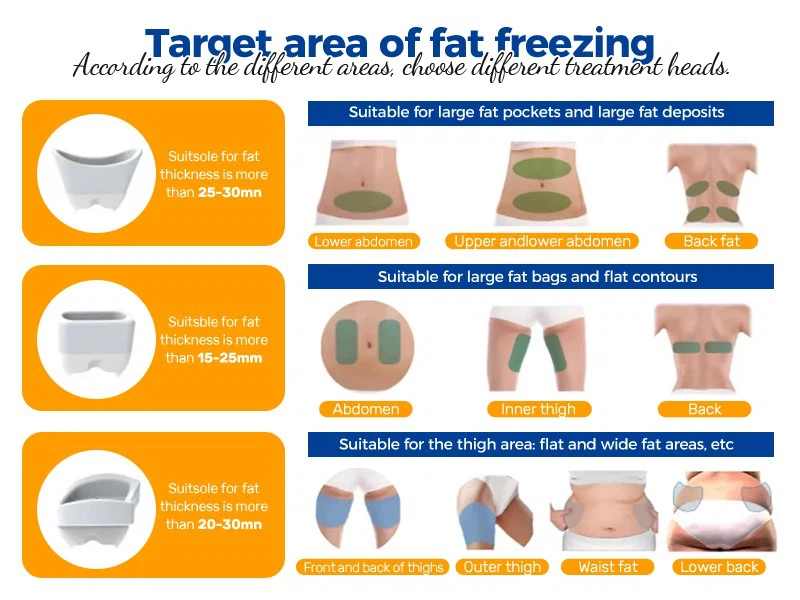 cryolipolysis body slimming machine 4