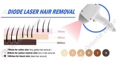 دستگاههای لیزر دیود کنترلشده اندروید{0}بهینهسازی شده برای همه انواع پوست و...